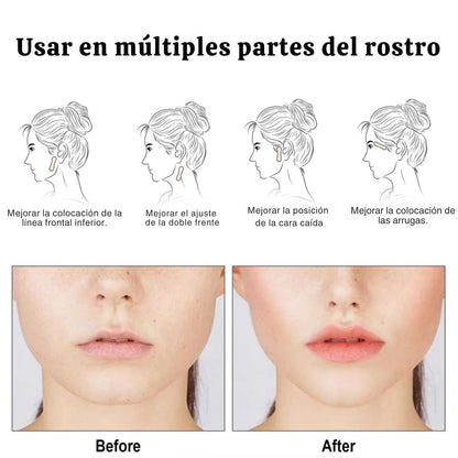 InvisiLift™ – Parches Faciales Lifting (40uni x Caja)